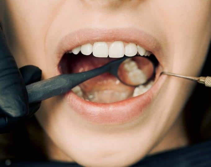 Protégez votre sourire avec une mutuelle dentaire adaptée – Guide complet